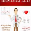 illustrated ecg a step by step approach to ecg illustrated medical series 187x3001 1