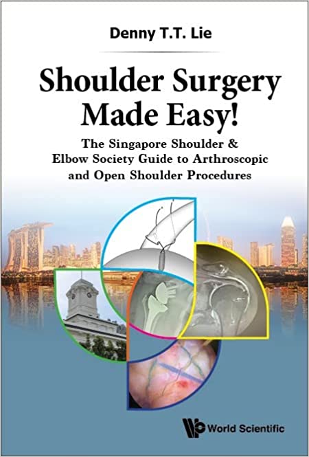 Shoulder Surgery Made Easy