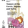 Tumors of the Cervix